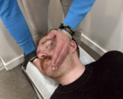 Chiropractic for neck pain